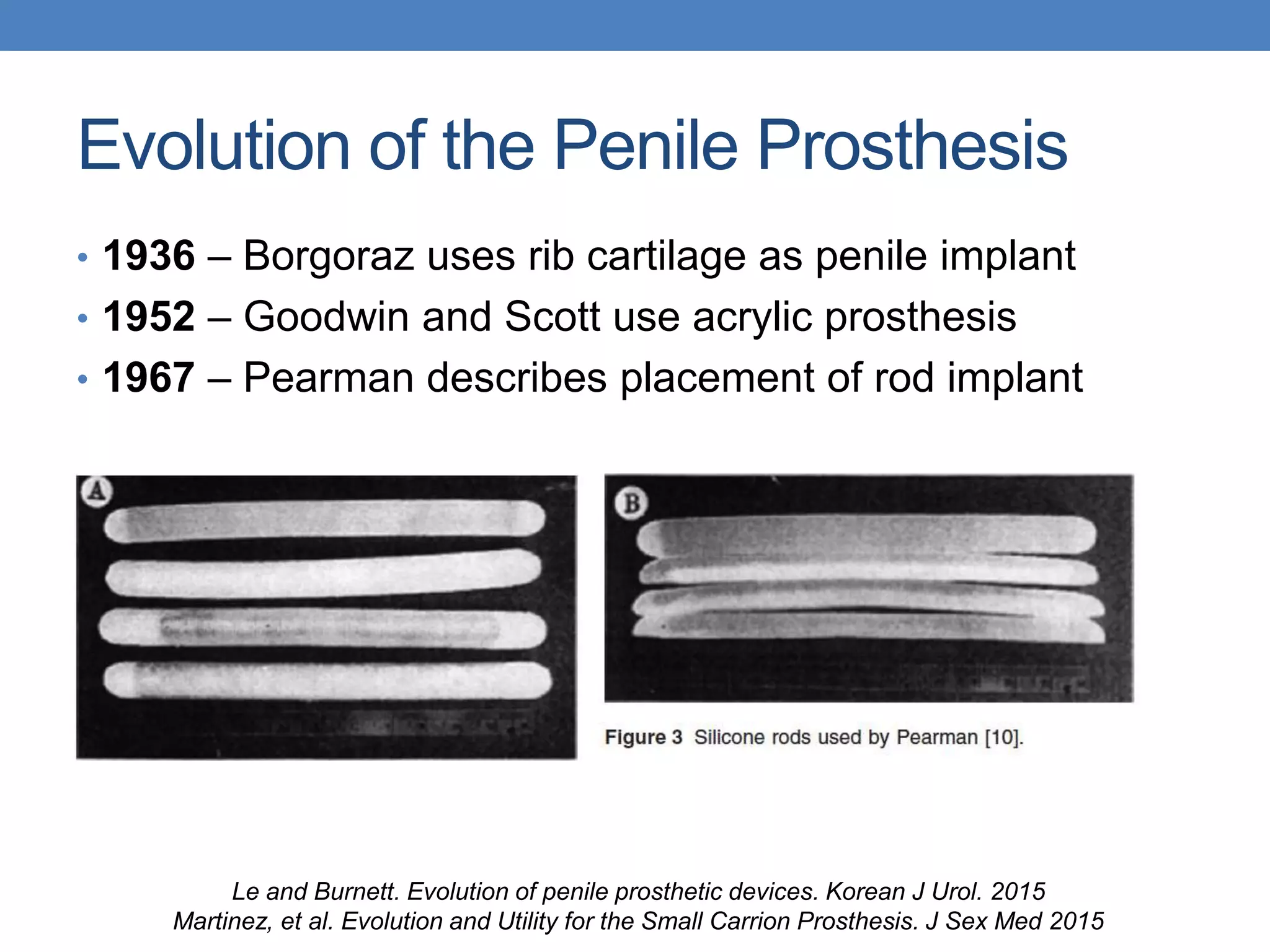 Ethical Dilemmas in Penile Prosthesis Surgery | PPT