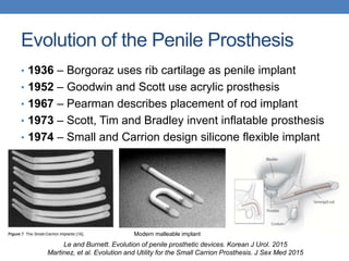 Scott Inflatable Prothesis Ethical Dilemmas in Penile Prosthesis Surgery | PPTX