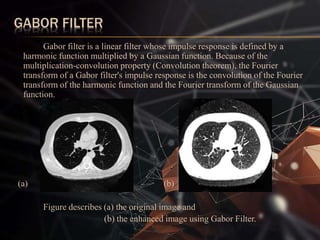 GABOR FILTER
Gabor filter is a linear filter whose impulse response is defined by a
harmonic function multiplied by a Gaussian function. Because of the
multiplication-convolution property (Convolution theorem), the Fourier
transform of a Gabor filter's impulse response is the convolution of the Fourier
transform of the harmonic function and the Fourier transform of the Gaussian
function.
(a) (b)
Figure describes (a) the original image and
(b) the enhanced image using Gabor Filter.
 