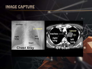 CANCER CELL DETECTION USING DIGITAL IMAGE PROCESSING | PPTX