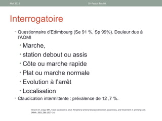 Mai 2011                                                                  Dr Pascal Boulet




Interrogatoire
   • Questionnaire d’Edimbourg (Se 91 %, Sp 99%). Douleur due à
      l’AOMI
       • Marche,
       • station debout ou assis
       • Côte ou marche rapide
       • Plat ou marche normale
       • Evolution à l’arrêt
       • Localisation
   • Claudication intermittente : prévalence de 12 ,7 %.

           Hirsch AT, Criqui MH, Treat-Jacobson D, et al. Peripheral arterial disease detection, awareness, and treatment in primary care.
           JAMA. 2001;286:1317–24.
 