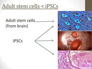 Adult stem cells < iPSCs

 Adult stem cells
 (from brain)


    iPSCs
 
