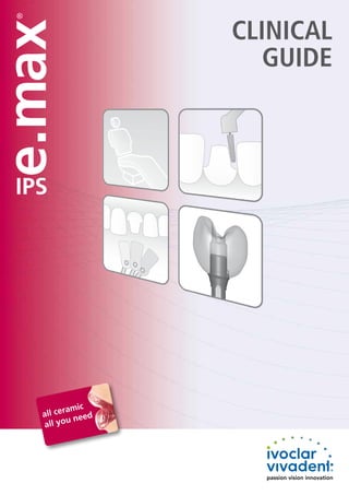 all ceramic
all you need
Clinical
Guide
 