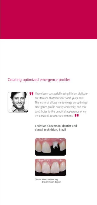 Creating optimized emergence profiles


            „   I have been successfully using lithium disilicate
                on titanium abutments for some years now.
                This material allows me to create an optimized
                emergence profile quickly and easily, and this
                contributes to the beautiful appearance of my


                                                      ”
                IPS e.max all-ceramic restorations.


                Christian Coachman, dentist and
                dental technician, Brazil




                Clinician:  auro Fradeani, Italy
                           M
                           Eric von Dooren, Belgium
 