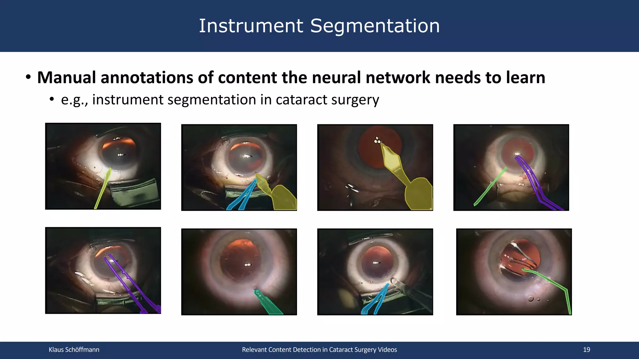 • Manual annotations of content the neural network needs to learn
• e.g., instrument segmentation in cataract surgery
Instrument Segmentation
Klaus Schöffmann Relevant Content Detection in Cataract Surgery Videos 19
 