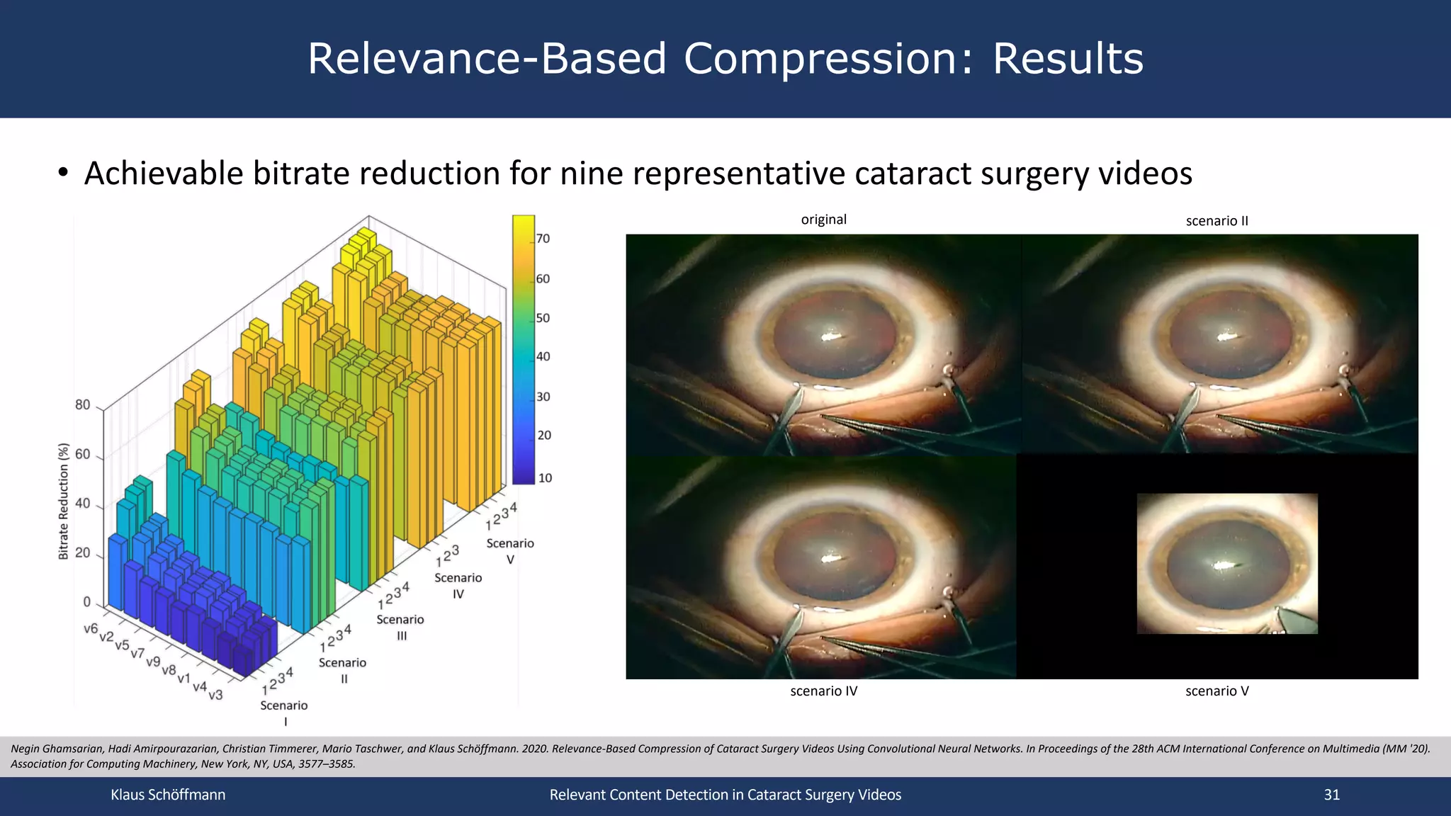 • Achievable bitrate reduction for nine representative cataract surgery videos
Relevance-Based Compression: Results
Relevant Content Detection in Cataract Surgery Videos
Negin Ghamsarian, Hadi Amirpourazarian, Christian Timmerer, Mario Taschwer, and Klaus Schöffmann. 2020. Relevance-Based Compression of Cataract Surgery Videos Using Convolutional Neural Networks. In Proceedings of the 28th ACM International Conference on Multimedia (MM '20).
Association for Computing Machinery, New York, NY, USA, 3577–3585.
original scenario II
scenario IV scenario V
Klaus Schöffmann 31
 
