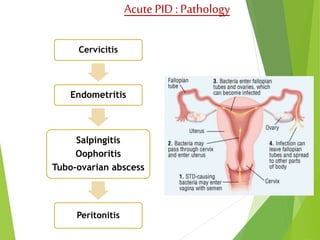 Acute PID : Pathology 
Cervicitis 
Endometritis 
Salpingitis 
Oophoritis 
Tubo-ovarian abscess 
Peritonitis 
 