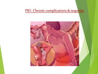 PID : Chronic complications & sequelae 
 