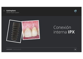 Implante dental Ipx Galimplant
