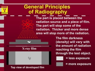 Radiography Testing.ppt