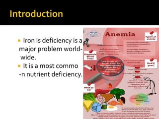  Iron is deficiency is a
major problem world-
wide.
 It is a most commo
-n nutrient deficiency.
 