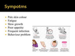  Pale skin colour
 Fatigue
 Slow growth
 Poor oppetite
 Frequent infection
 Behaviour problem
 