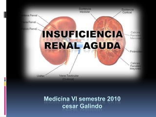 INSUFICIENCIA RENAL AGUDA  Medicina VI semestre 2010cesar Galindo 