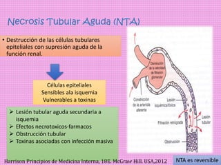 Insuficiencia Renal Aguda ppt insuficiencia-renal-aguda-ppt