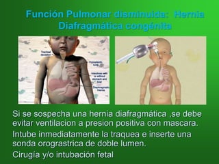 Función Pulmonar disminuida: Hernia
Diafragmática congénita
Si se sospecha una hernia diafragmática ,se debe
evitar ventilacion a presion positiva con mascara.
Intube inmediatamente la traquea e inserte una
sonda orograstrica de doble lumen.
Cirugía y/o intubación fetal
 