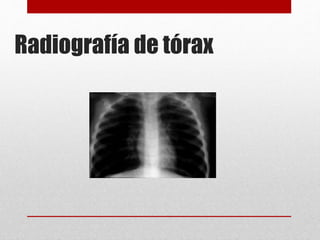 Radiografía de tórax
 
