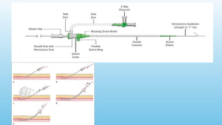 Advanced Monitoring and Cardiac Resuscitation Techniques ,Instrumentations,co2 angiography,ACT equiment, in Interventional Radiology