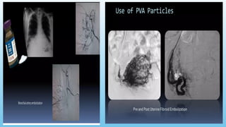 Advanced Monitoring and Cardiac Resuscitation Techniques ,Instrumentations,co2 angiography,ACT equiment, in Interventional Radiology