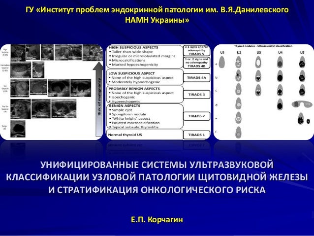 Номер хавал узловая