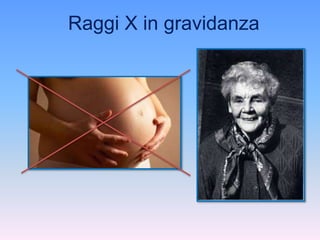 Raggi X in gravidanza 
 