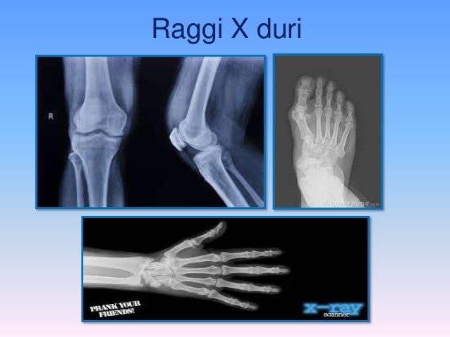 Chi Ha Inventato I Raggi X