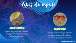 Muestras de laboratorio esputo-AED | PDF