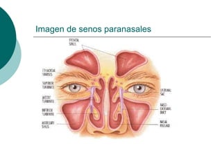 Imagen de senos paranasales
 