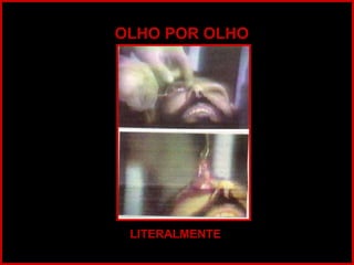OLHO POR OLHO LITERALMENTE 