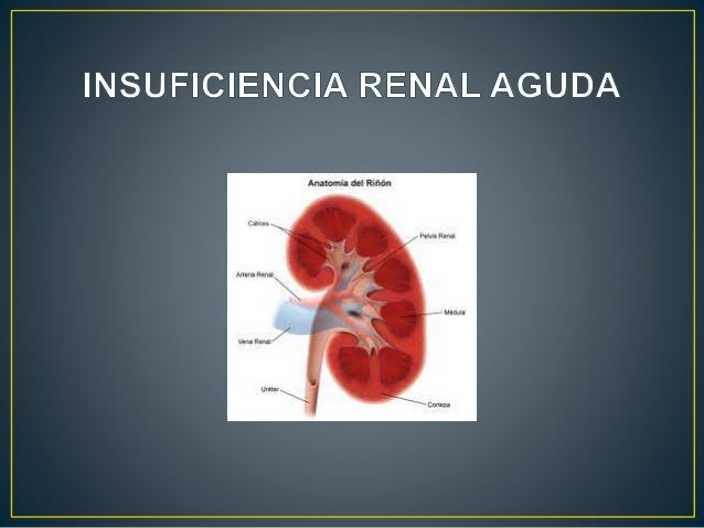 Insuficiencia renal aguda Insuficiencia renal aguda