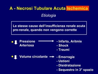 A - Necrosi Tubulare Acuta Ischemica Etiologia Le stesse cause dell’insufficienza renale acuta  pre-renale, quando non vengono corrette • • Pressione Arteriosa Volume circolante - Infarto, Aritmie  - Shock  - Traumi  - Emorragie - Ustioni - Disidratazione - Sequestro in 3° spazio 