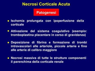 Necrosi Corticale Acuta Patogenesi Deposizione di fibrina e formazione di trombi intravascolari alle arteriole, piccole arterie e fino alle arterie di calibro maggiore Necrosi massiva di tutte le strutture componenti il parenchima della corticale renale Attivazione del sistema coagulativo (esempio: tromboplastina placentare in corso di gravidanza) • • • • Ischemia prolungata con ipoperfusione della corticale 