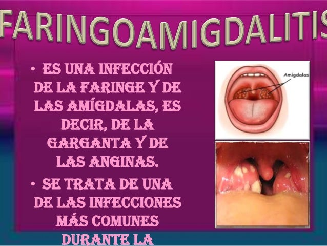 Infecciones De La Garganta Related Keywords - Infecciones Infecciones De La Garganta Related Keywords - Infecciones