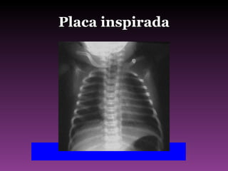 Placa inspirada 