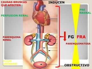 CAUSAS BRUSCAS    INDUCEN
QUE AFECTEN
                                   PRE
                                   RRENAL
PERFUSION RENAL




PARENQUIMA                   FG FRA
RENAL
                            PARENQUIMATOSA




 FLUJO
 URINARIO
                        OBSTRUCTIVO
 