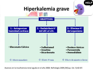 Hiperkalemia grave
Avances en la insuficiencia renal aguda en el año 2008. Nefrología 2009;29(Sup. Ext. 5):82-87.
 