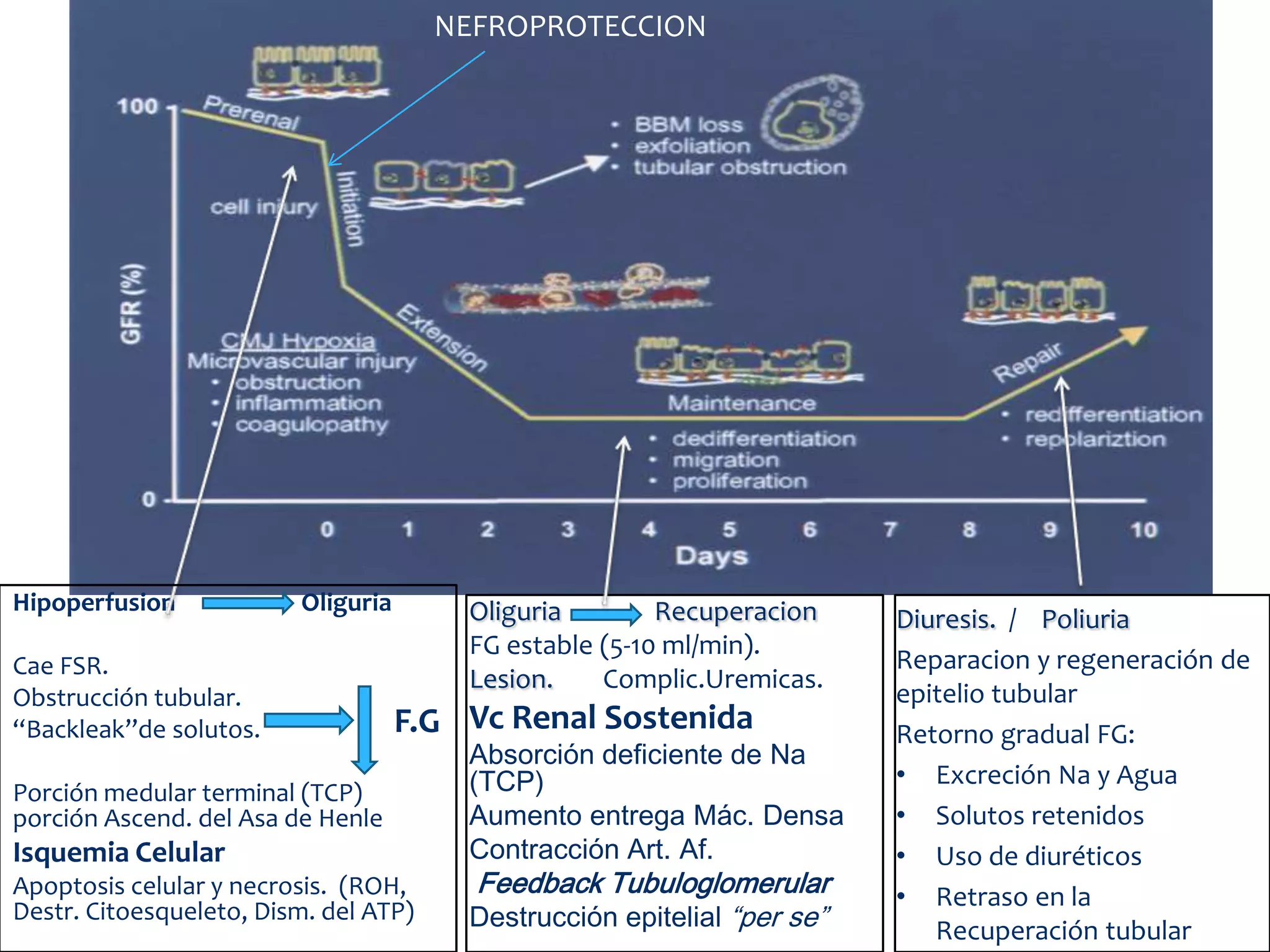NEFROPROTECCION




Hipoperfusion            Oliguria       Oliguria        Recuperacion     Diuresis. / Poliuria
                                        FG estable (5-10 ml/min).
Cae FSR.                                                                 Reparacion y regeneración de
                                        Lesion.    Complic.Uremicas.
Obstrucción tubular.                                                     epitelio tubular
“Backleak”de solutos.               F.G Vc Renal Sostenida               Retorno gradual FG:
                                        Absorción deficiente de Na
                                        (TCP)                            • Excreción Na y Agua
Porción medular terminal (TCP)
porción Ascend. del Asa de Henle        Aumento entrega Mác. Densa       • Solutos retenidos
Isquemia Celular                        Contracción Art. Af.             • Uso de diuréticos
Apoptosis celular y necrosis. (ROH,     Feedback Tubuloglomerular        • Retraso en la
Destr. Citoesqueleto, Dism. del ATP)    Destrucción epitelial “per se”      Recuperación tubular
 