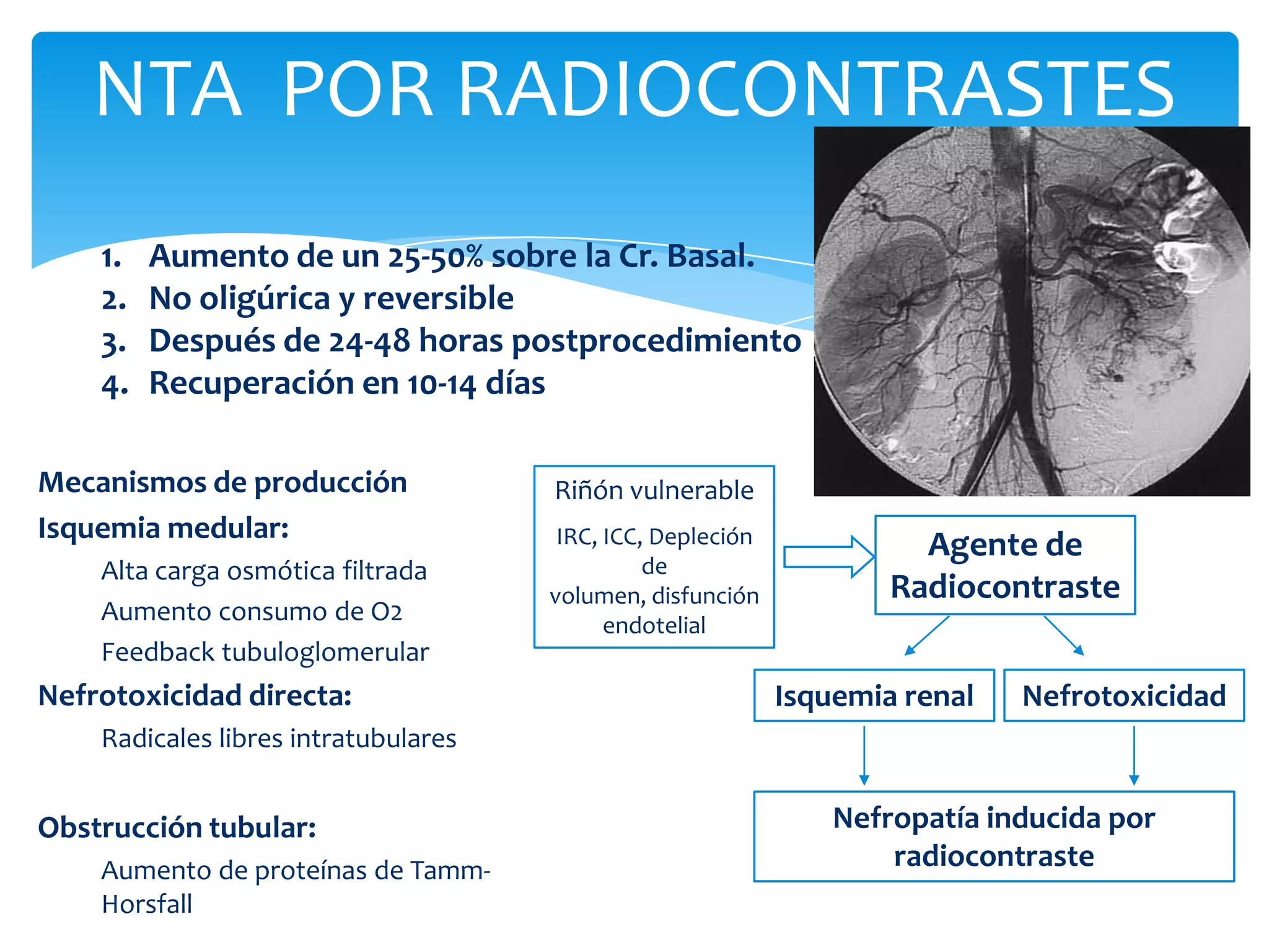 NTA POR RADIOCONTRASTES
    1.   Aumento de un 25-50% sobre la Cr. Basal.
    2.   No oligúrica y reversible
    3.   Después de 24-48 horas postprocedimiento
    4.   Recuperación en 10-14 días

Mecanismos de producción              Riñón vulnerable
Isquemia medular:                      IRC, ICC, Depleción             Agente de
    Alta carga osmótica filtrada                de
                                      volumen, disfunción            Radiocontraste
    Aumento consumo de O2                   endotelial
    Feedback tubuloglomerular
Nefrotoxicidad directa:                                      Isquemia renal   Nefrotoxicidad
    Radicales libres intratubulares


Obstrucción tubular:                                             Nefropatía inducida por
    Aumento de proteínas de Tamm-                                    radiocontraste
    Horsfall
 