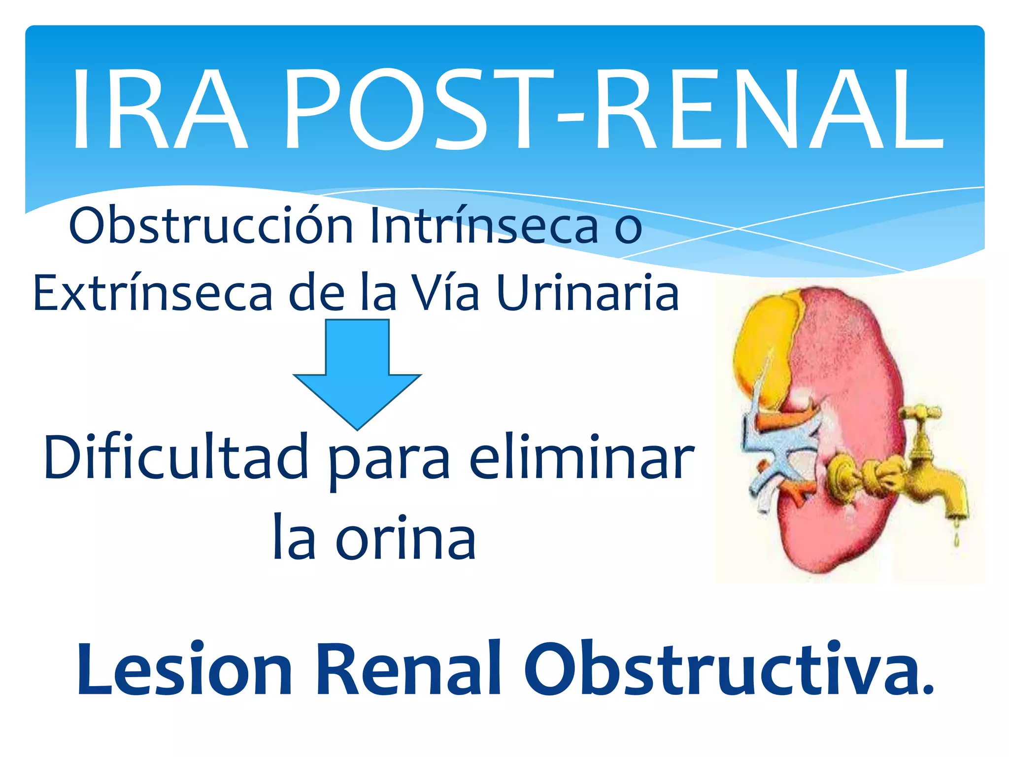 IRA POST-RENAL
 Obstrucción Intrínseca o
Extrínseca de la Vía Urinaria


Dificultad para eliminar
         la orina

 Lesion Renal Obstructiva.
 
