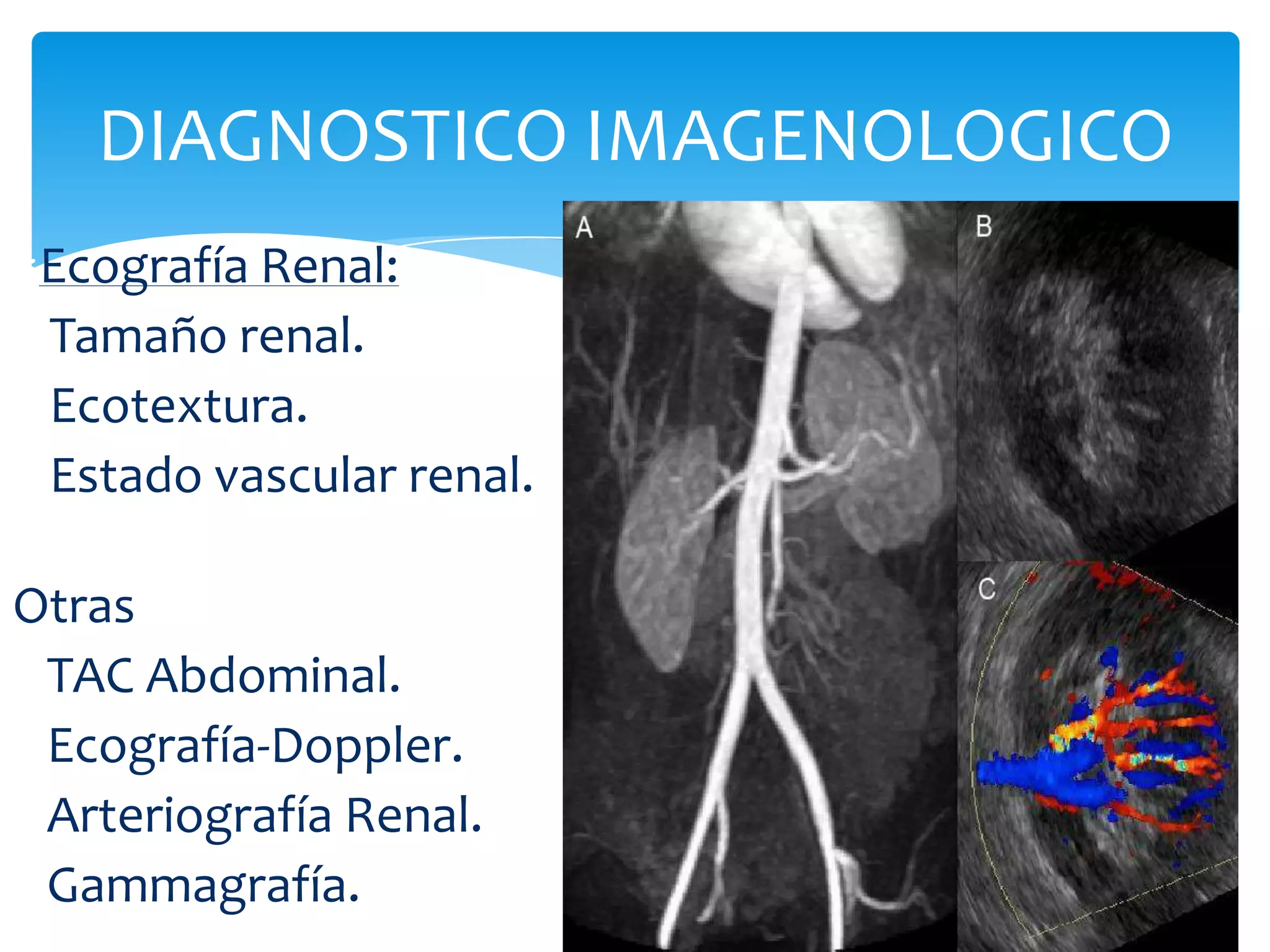 DIAGNOSTICO IMAGENOLOGICO
 Ecografía Renal:
 Tamaño renal.
 Ecotextura.
 Estado vascular renal.

Otras
 TAC Abdominal.
 Ecografía-Doppler.
 Arteriografía Renal.
 Gammagrafía.
 