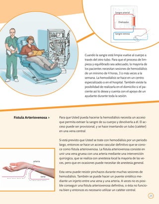 Sangre arterial


                                                                           Dializador



                                                                        Sangre venosa




                                                Cuando la sangre está limpia vuelve al cuerpo a
                                                través del otro tubo. Para que el proceso de lim-
                                                pieza y equilibrado sea adecuado, la mayoría de
                                                los pacientes necesitan sesiones de hemodiálisis
                                                de un mínimo de 4 horas, 3 o más veces a la
                                                semana. La hemodiálisis se hace en un centro
                                                especializado o en el hospital. También existe la
                                                posibilidad de realizarla en el domicilio si el pa-
                                                ciente así lo desea y cuenta con el apoyo de un
                                                ayudante durante toda la sesión.




Fístula Arteriovenosa >      Para que Usted pueda hacerse la hemodiálisis necesita un acceso
                             que permita extraer la sangre de su cuerpo y devolverla a él. El ac-
                             ceso puede ser provisional, y se hace insertando un tubo (catéter)
                             en una vena central.

                             Si está previsto que Usted se trate con hemodiálisis por un periodo
                             largo, entonces se hace un acceso vascular definitivo que se cono-
                             ce como fístula arteriovenosa. La fístula arteriovenosa consiste en
                             unir una vena gruesa con una arteria mediante una intervención
                             quirúrgica, que se realiza con anestesia local la mayoría de las ve-
            arteria
                             ces, pero que en ocasiones puede necesitar de anestesia general.

                             Esta vena puede resistir pinchazos durante muchas sesiones de
                      vena   hemodiálisis. También se puede hacer un puente sintético me-
                             diante un injerto entre una vena y una arteria. A veces no es posi-
                             ble conseguir una fístula arteriovenosa definitiva, o ésta no funcio-
                             na bien y entonces es necesario utilizar un catéter central.
                                                                                                      25
 