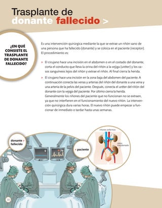 Trasplante de
      donante fallecido >

                  Es una intervención quirúrgica mediante la que se extrae un riñón sano de
   ¿EN QUÉ        una persona que ha fallecido (donante) y se coloca en el paciente (receptor).
CONSISTE EL
                  El procedimiento es:
TRASPLANTE
DE DONANTE
                  >	 El cirujano hace una incisión en el abdomen o en el costado del donante,
 FALLECIDO?
                     corta el conducto que lleva la orina del riñón a la vejiga (uréter) y los va-
                     sos sanguíneos lejos del riñón y extrae el riñón. Al final cierra la herida.
                  >	 El cirujano hace una incisión en la zona baja del abdomen del paciente. A
                     continuación conecta las venas y arterias del riñón del donante a una vena y
                     una arteria de la pelvis del paciente. Después, conecta el uréter del riñón del
                     donante con la vejiga del paciente. Por último cierra la herida.
                  	 Generalmente los riñones del paciente que no funcionan no se extraen,
                     ya que no interfieren en el funcionamiento del nuevo riñón. La interven-
                     ción quirúrgica dura varias horas. El nuevo riñón puede empezar a fun-
                     cionar de inmediato o tardar hasta unas semanas.




                                                                riñones enfermos




      donante >
      fallecido                                                                    riñón
                                                                                   trasplantado

                                            < paciente




 30
 