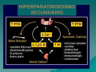 HIPERPARATIROIDISMO
SECUNDÁRIO
 