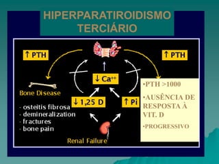 HIPERPARATIROIDISMO
TERCIÁRIO
•PTH >1000
•AUSÊNCIA DE
RESPOSTA À
VIT. D
•PROGRESSIVO
 