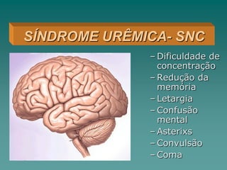 – Dificuldade de
concentração
– Redução da
memória
– Letargia
– Confusão
mental
– Asterixs
– Convulsão
– Coma
SÍNDROME URÊMICA- SNC
 
