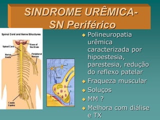  Polineuropatia
urêmica
caracterizada por
hipoestesia,
parestesia, redução
do reflexo patelar
 Fraqueza muscular
 Soluços
 MM ?
 Melhora com diálise
e TX
SINDROME URÊMICA-
SN Periférico
 