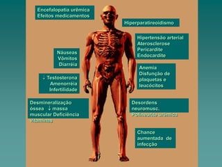 Encefalopatia urêmica
Efeitos medicamentos
Hiperparatireoidismo
Náuseas
Vômitos
Diarréia
 Testosterona
Amenorréia
Infertilidade
Desordens
neuromusc.
Polineurite urêmica
Desmineralização
óssea  massa
muscular Deficiência
vitaminas
Hipertensão arterial
Aterosclerose
Pericardite
Endocardite
Anemia
Disfunção de
plaquetas e
leucócitos
Chance
aumentada de
infecção
 