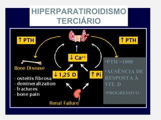 HIPERPARATIROIDISMO
TERCIÁRIO
•PTH >1000
•AUSÊNCIA DE
RESPOSTA À
VIT. D
•PROGRESSIVO
 