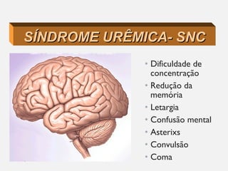• Dificuldade de
concentração
• Redução da
memória
• Letargia
• Confusão mental
• Asterixs
• Convulsão
• Coma
SÍNDROME URÊMICA- SNCSÍNDROME URÊMICA- SNC
 
