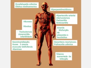 Encefalopatia urêmicaEncefalopatia urêmica
Efeitos medicamentosEfeitos medicamentos
HiperparatireoidismoHiperparatireoidismo
NáuseasNáuseas
VômitosVômitos
DiarréiaDiarréia↓ TestosteronaTestosterona
AmenorréiaAmenorréia
InfertilidadeInfertilidade
Desordens neuromusc.Desordens neuromusc.
Polineurite urêmicaPolineurite urêmica
DesmineralizaçãoDesmineralização
ósseaóssea ↓↓ massamassa
muscular Deficiênciamuscular Deficiência
vitaminasvitaminas
Hipertensão arterialHipertensão arterial
AteroscleroseAterosclerose
PericarditePericardite
EndocarditeEndocardite
AnemiaAnemia
DisfunçãoDisfunção
dede
plaquetas eplaquetas e
leucócitosleucócitos
ChanceChance
aumentada deaumentada de
infecçãoinfecção
 