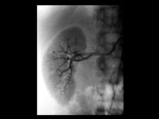Normal Intestines Ir +IR cases 1.ppt